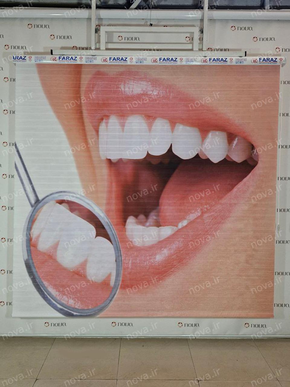 نمونه اجرا شده محصول پرده سیلوئت تصویری طرح دندانپزشکی کد BSN-07 | دکوراسیون نووا